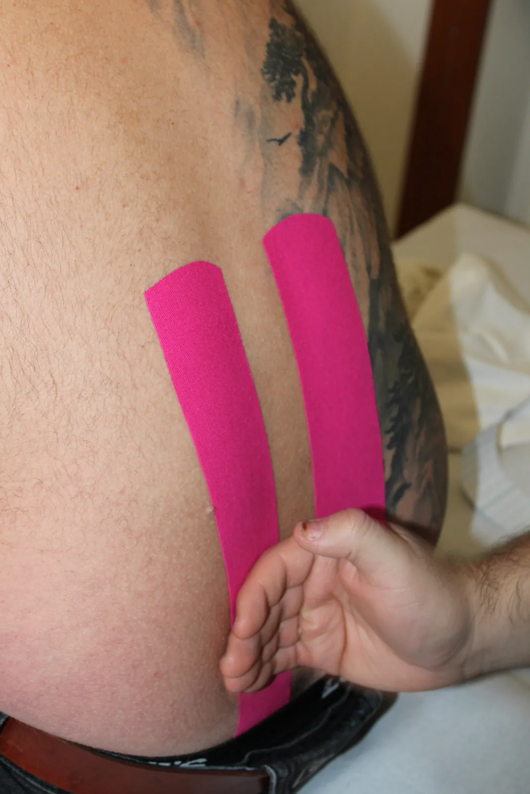 Applicazione di kinesiotaping su un paziente